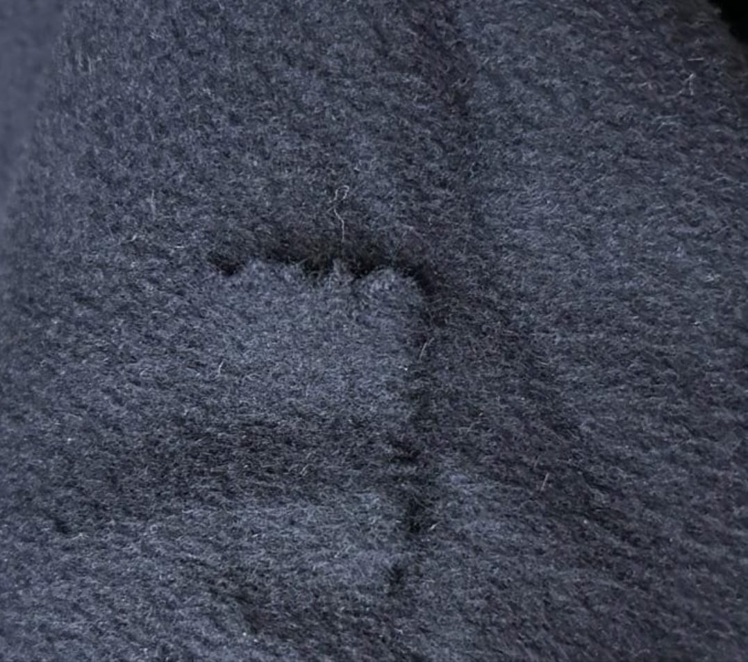 Blauer Wollmantel vorher – Schaden vor der Reparatur